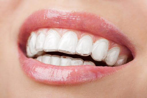 ORTHODONTICS (Braces & Invisalign)